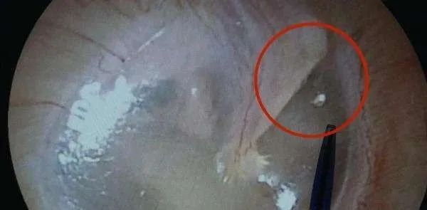 小姐姐亲猫，脸上竟长了「脚气」！养宠这些卫生问题千万别忽略(图8)
